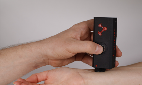 In vivo skin measurements
